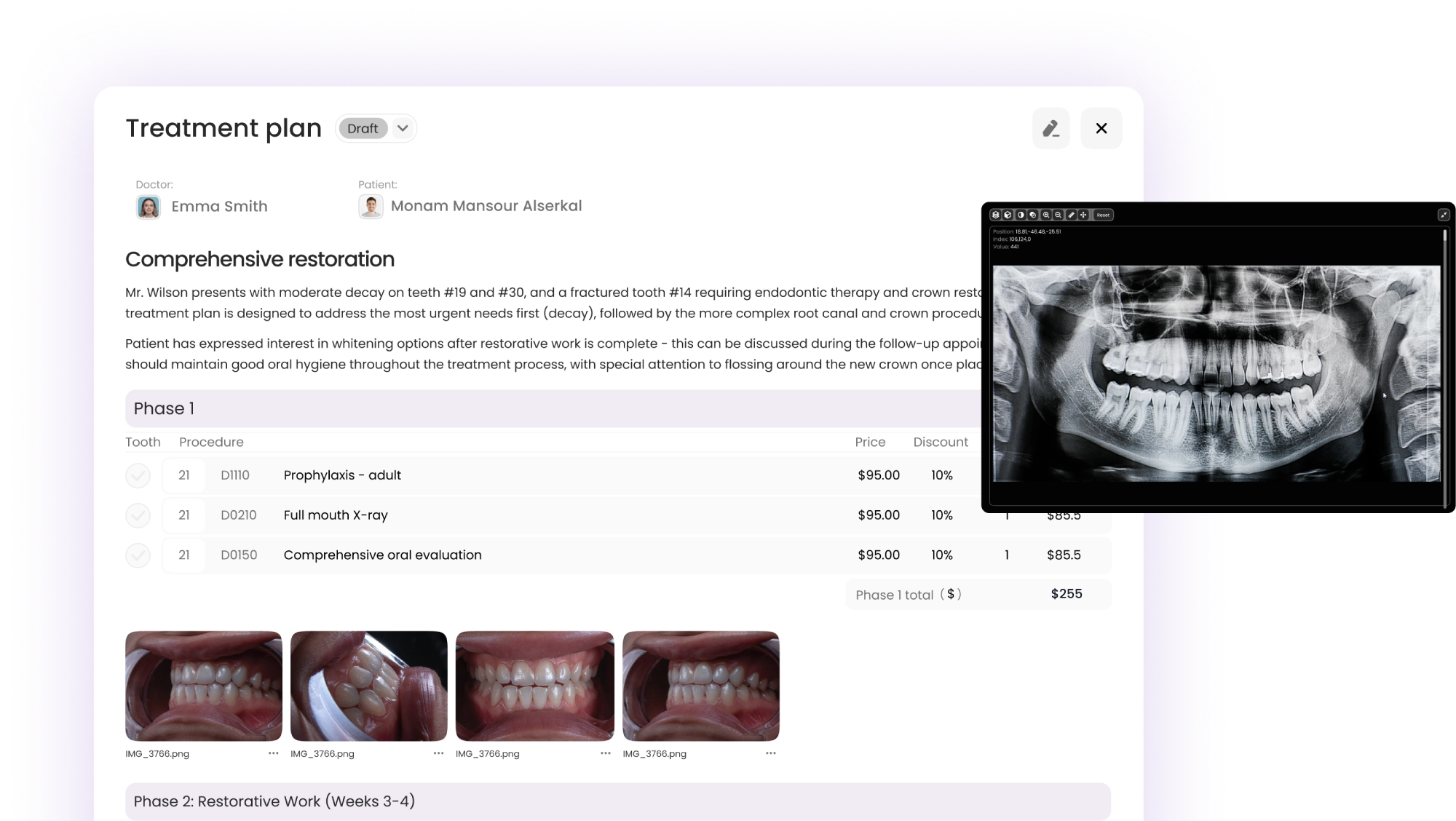 Treatment Planning interface
